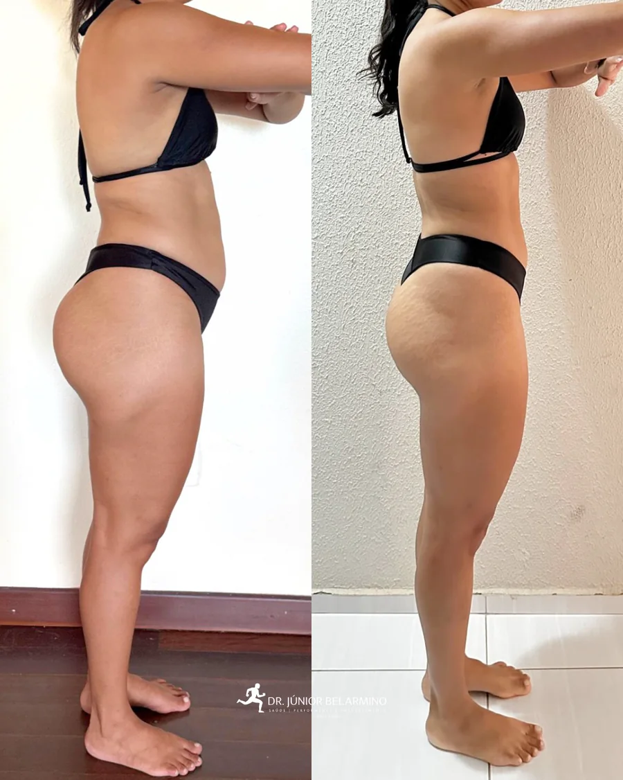 Comparação autorizada de evolução individual